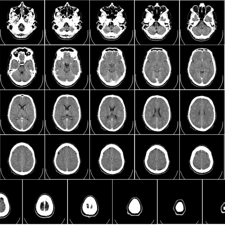 computer-tomography-62942